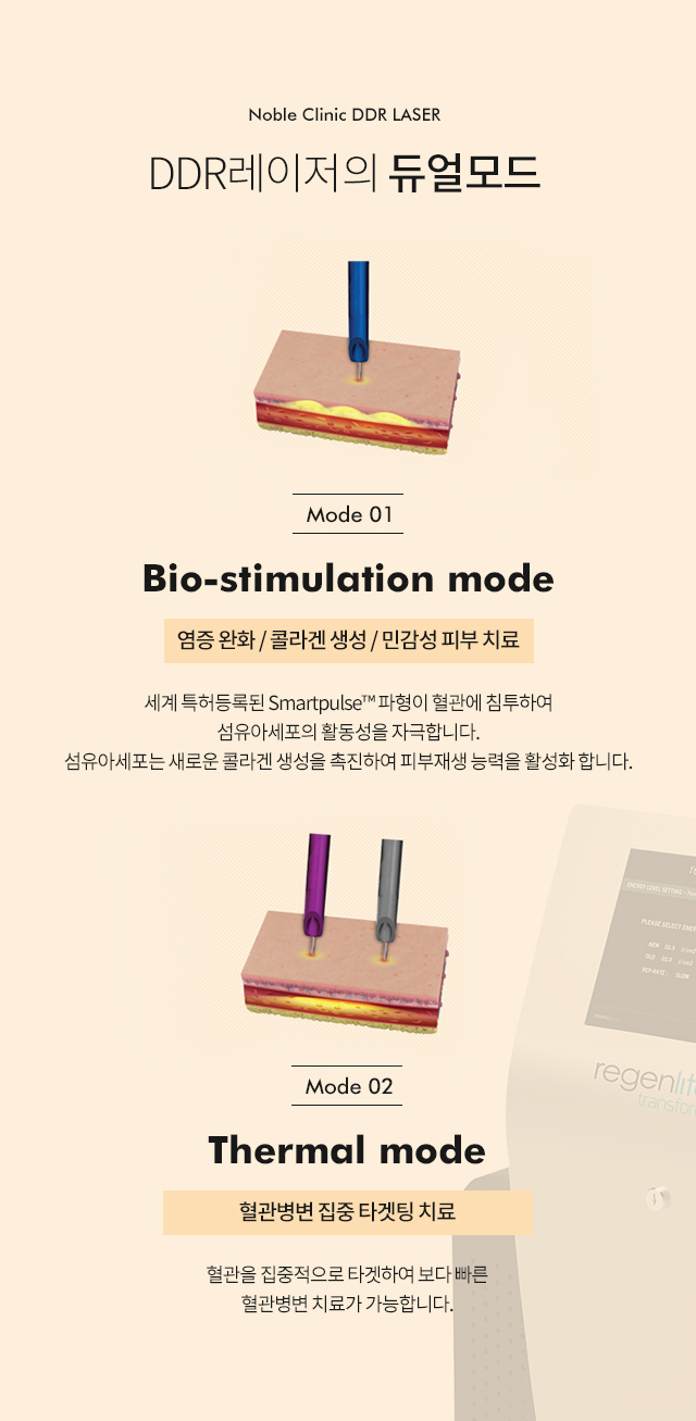 DDR레이저