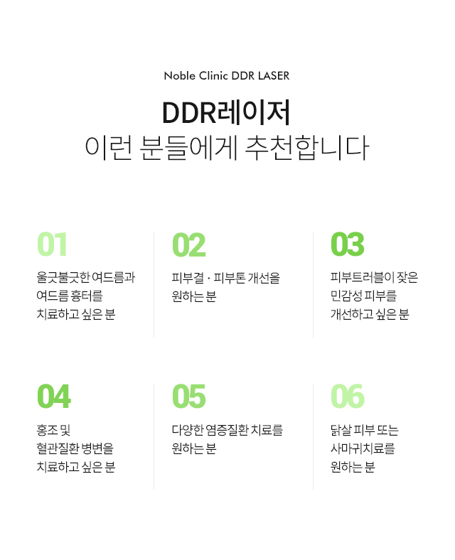 DDR레이저